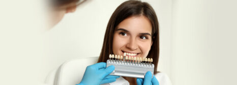 FAQs on Porcelain Veneers