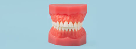 What to Expect After Tooth Extractions for Dentures