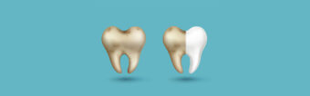 How to Get Rid of Stains on Teeth: Dentist-Approved Solutions