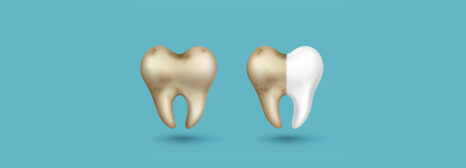 How to Get Rid of Stains on Teeth: Dentist-Approved Solutions