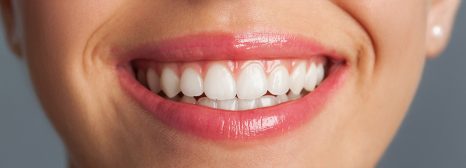 Thinking About Teeth Whitening? Here’s How White Your Smile Can Get