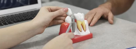 Do Dental Implants Get Cavities? What Patients Should Know